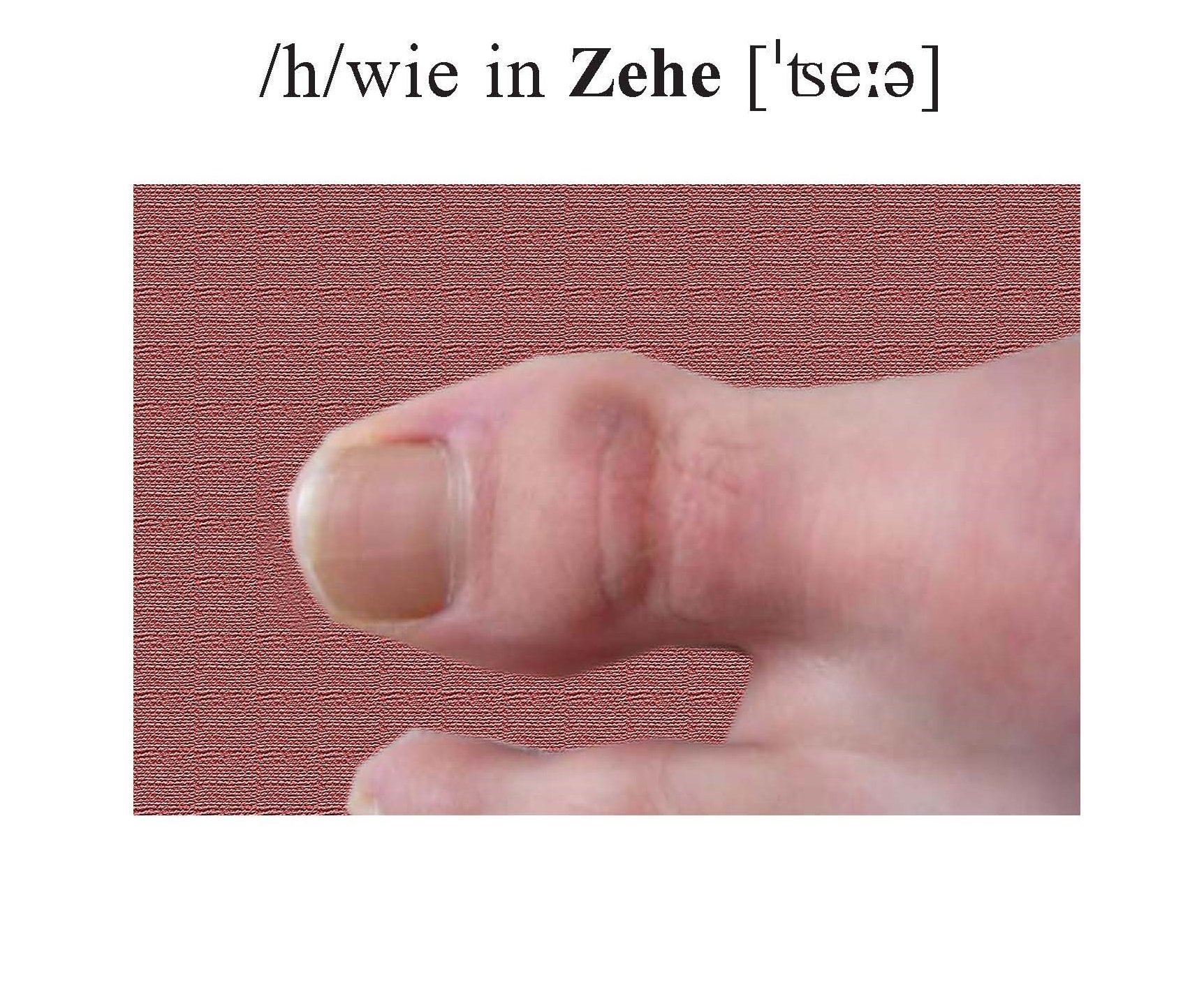 Zehe