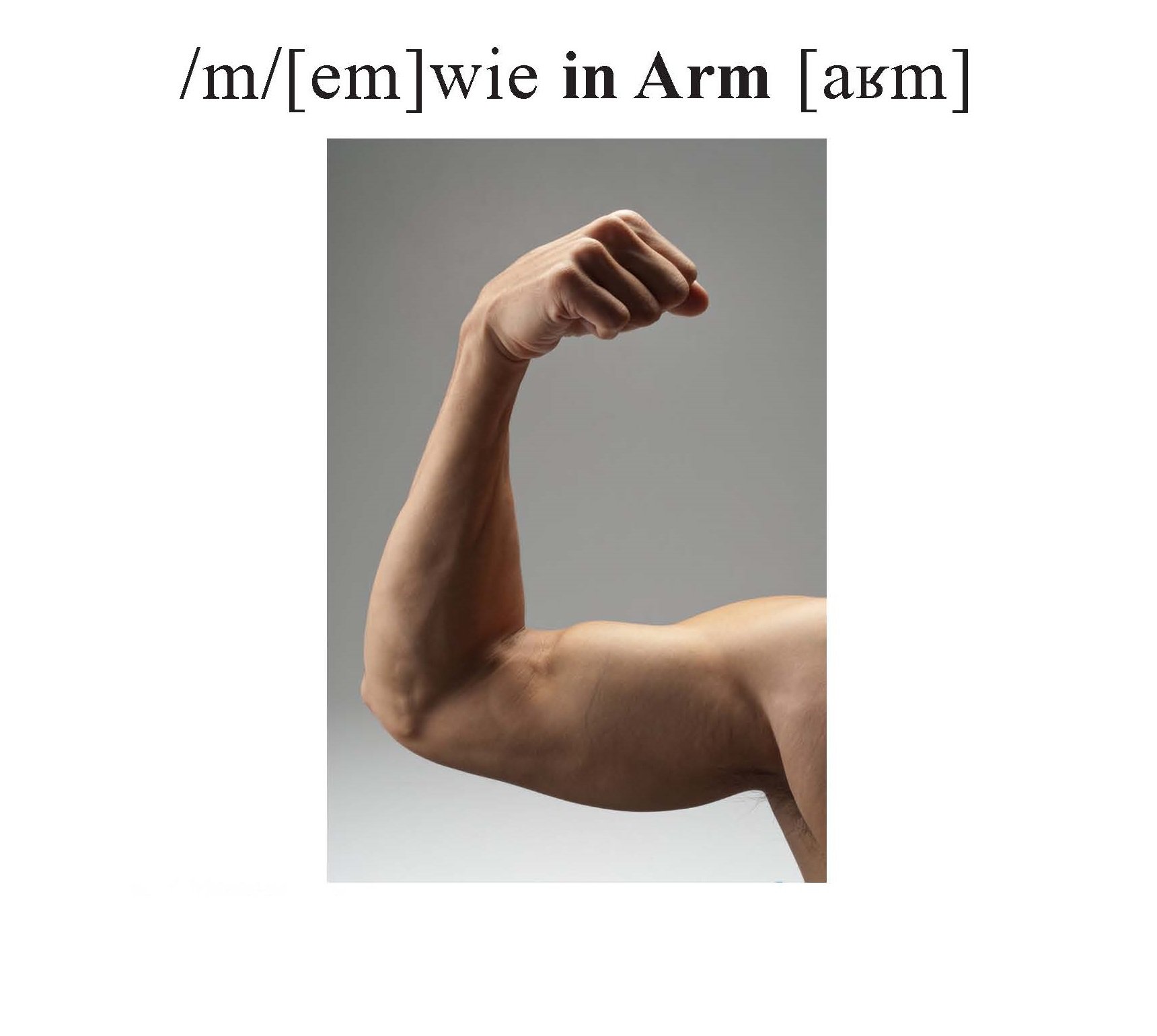 Arm